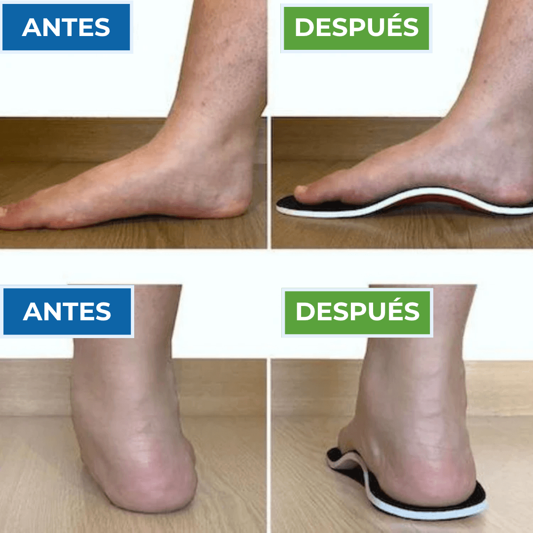 Plantillas Ortopédicas para Arco y Fascitis Plantar