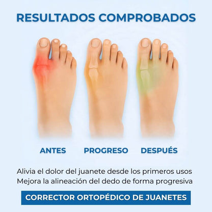 Corrector Ortopédico de Juanetes