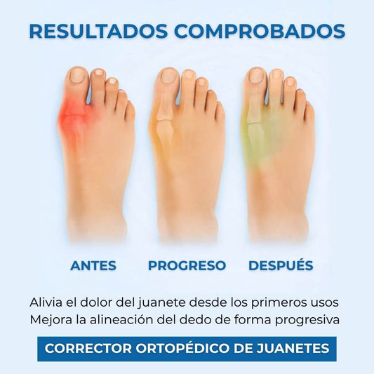 Corrector Ortopédico de Juanetes